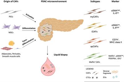 Tumor-Stroma Interaction in PDAC as a New Approach for Liquid Biopsy and its Potential Clinical Implications